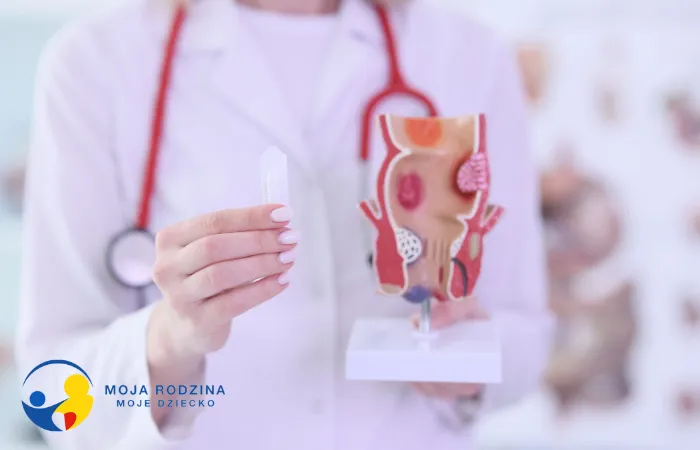 Консультація проктолога Варшава